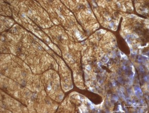 Stained Purkinje cells from Dr. Blatt's laboratory.